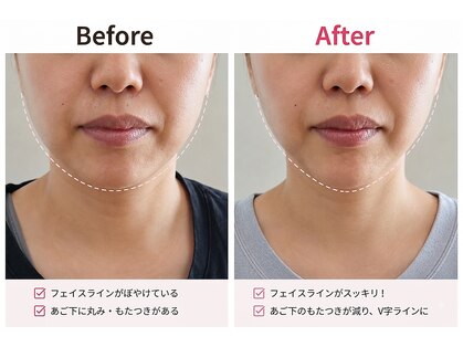 りんぱサロン まりの写真