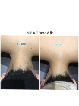 アンジュヴィバラヴィーダ(Ange viva la vida)/ビフォーアフター