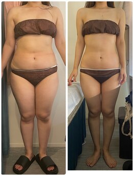 ストーミーストーン(STORMY STONE by Aphros Queen)/やく石浴VIPコース3ヶ月