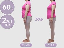 ビップ 赤坂店(Bipp!)/60代・2カ月の変化