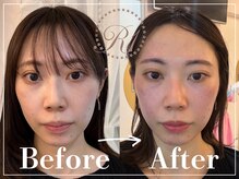R-1ビューティーサロン 表参道/Before＆After