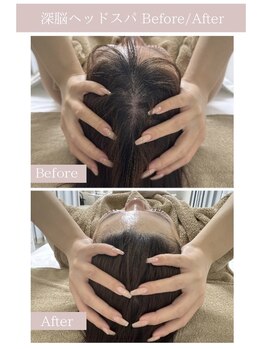 レミー(Remy)/ヘッドスパ　before/after