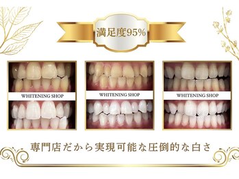 ホワイトニングショップ 越谷店