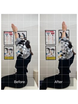 ナオル整体 福島院(naoru整体)/40代女性