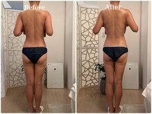 センス(SENSE)/【40代前半】全身のむくみ改善