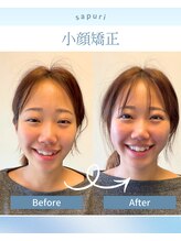 サプリ 梅田/印象を変える小顔＆姿勢矯正！