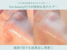 フォンビューティー(fon beauty)の雰囲気（開き・メラニン・詰まり・いちご鼻◎どんな毛穴にも対応します！）