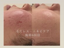 アールエーサロン 恵比寿 広尾(Ra salon)