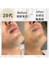 コミチ(KOMICHI)/ビフォーアフター