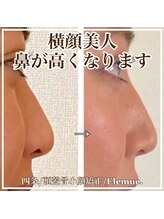 エレミュー 烏丸(Elemue.)/鼻が高くなって横顔美人