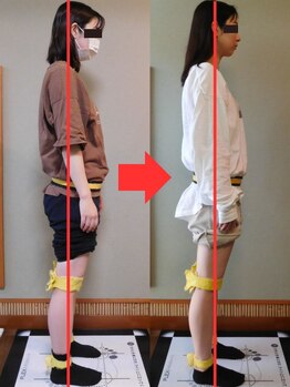 チャラク(charaku)/【20代M様：猫背・全身矯正】