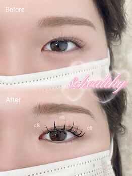 アテプラス(ate+)/&healthy　120本