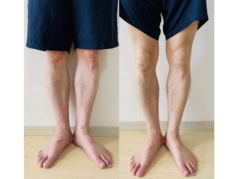 めぐらせの森/足から骨の配列を整える施術
