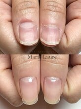 マリーロール 梅田店(Marie Laure)/自爪育成/深爪矯正/ネイルケア