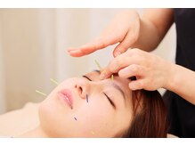 ラ コンシェル 武蔵小杉店/お悩みにオーダーメイド美鍼★