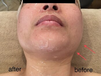 ビューティサロン ファイン(Fine)/50代/1回のケアで実感