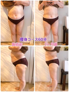プライベートサロン レイ(Ray)/痩身/お腹&足60分4回×約3ヶ月