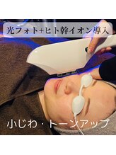 ジュノー ビューティー 綾瀬店(Juno Beauty)/光フォトSRフェイシャル