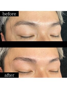 ユー 千葉駅前店(you)/症例写真