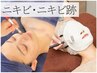 8/15迄【本気のニキビケア】ダイヤモンドピーリング+クールビタミン導入