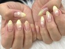【木村】イエロー×雲ネイル