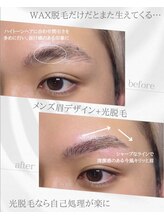 リノア(Linoa)/メンズ眉毛ビフォーアフター