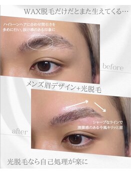 リノア(Linoa)/メンズ眉毛ビフォーアフター