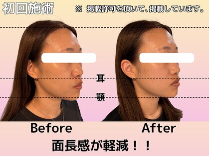 心晴。(コハル)の写真