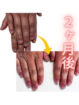 ヴェールリム(verl lim)/