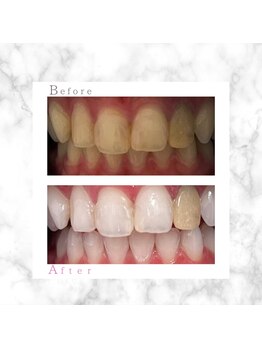 ホワイト 上乃木南店(WHITE)/ビフォーアフター