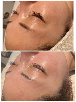 すっぴん美肌革命/肌トーン整い内側から輝く艶肌に