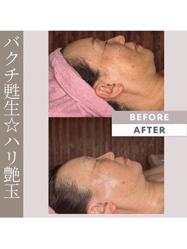ダノンナ(Da Nonna relaxation house)/バクチ甦生＆バスト☆姫路初