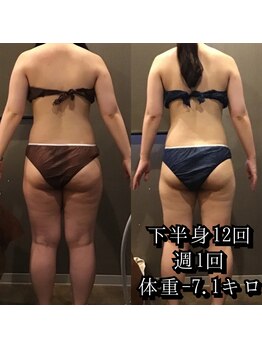 カルム エ コンポーゼ(Calme et Compose')/痩身セルゼロ/下半身12回