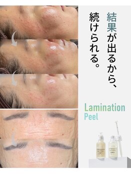 オフモード(OffMode)/ラミネーションピーリング