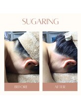 ベイジョ デ アンジョ(Beijo de anjo)/うなじシュガーリング