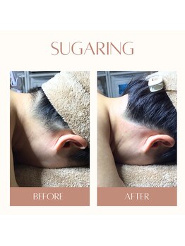 ベイジョ デ アンジョ(Beijo de anjo)/うなじシュガーリング