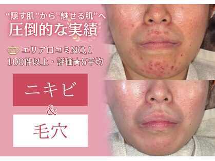 ルオン(Luon.)の写真