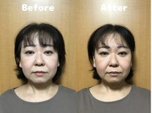 くにたちNyan鍼灸整体院/【小顔矯正】Before After 7