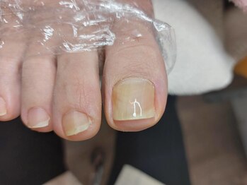 ＵＰジェル／塗り替えafter