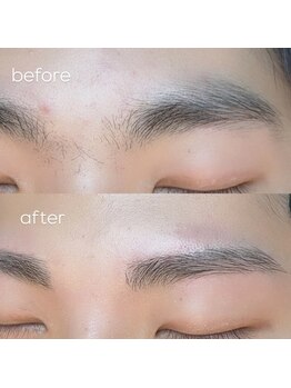 ハク 倉敷店(Haku.)/【メンズ】before・after