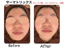 ラディアント たまプラーザ/《サーマトリックス》