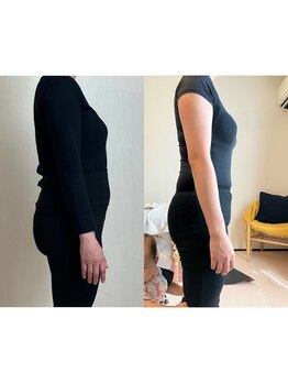 カラダミックス(karadamix)/ケアを受けてもうすぐ産後１年