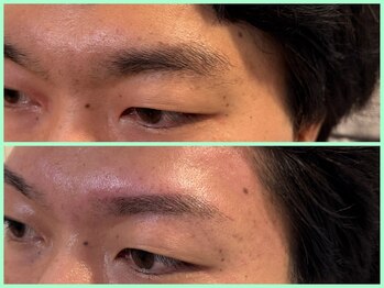 スリーピース(3Peace)/ストレート眉 Before/After