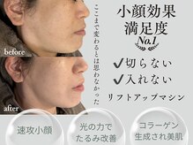 マイルーチェ 可児川合店(MyLuce)の雰囲気（切らない！入れない！リフトアップ！）