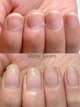 マリーロール 梅田店(Marie Laure)/自爪育成/深爪矯正/ネイルケア