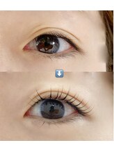 ビオールサロン 池袋東口(美allサロン)/施術前後