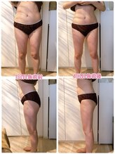 プライベートサロン レイ(Ray)/痩身/お腹&足60分4回約1ヶ月