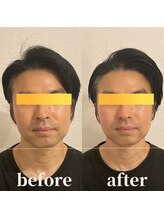 ロータス ビューティー(LOTUS Beauty)/小顔/歪み/エイジングケア