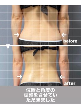 メゾン ド クロエ(Maison de Chloe)/CHLOE式痩身