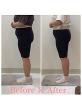 スタイルラボ高松/産後の骨盤矯正の効果♪